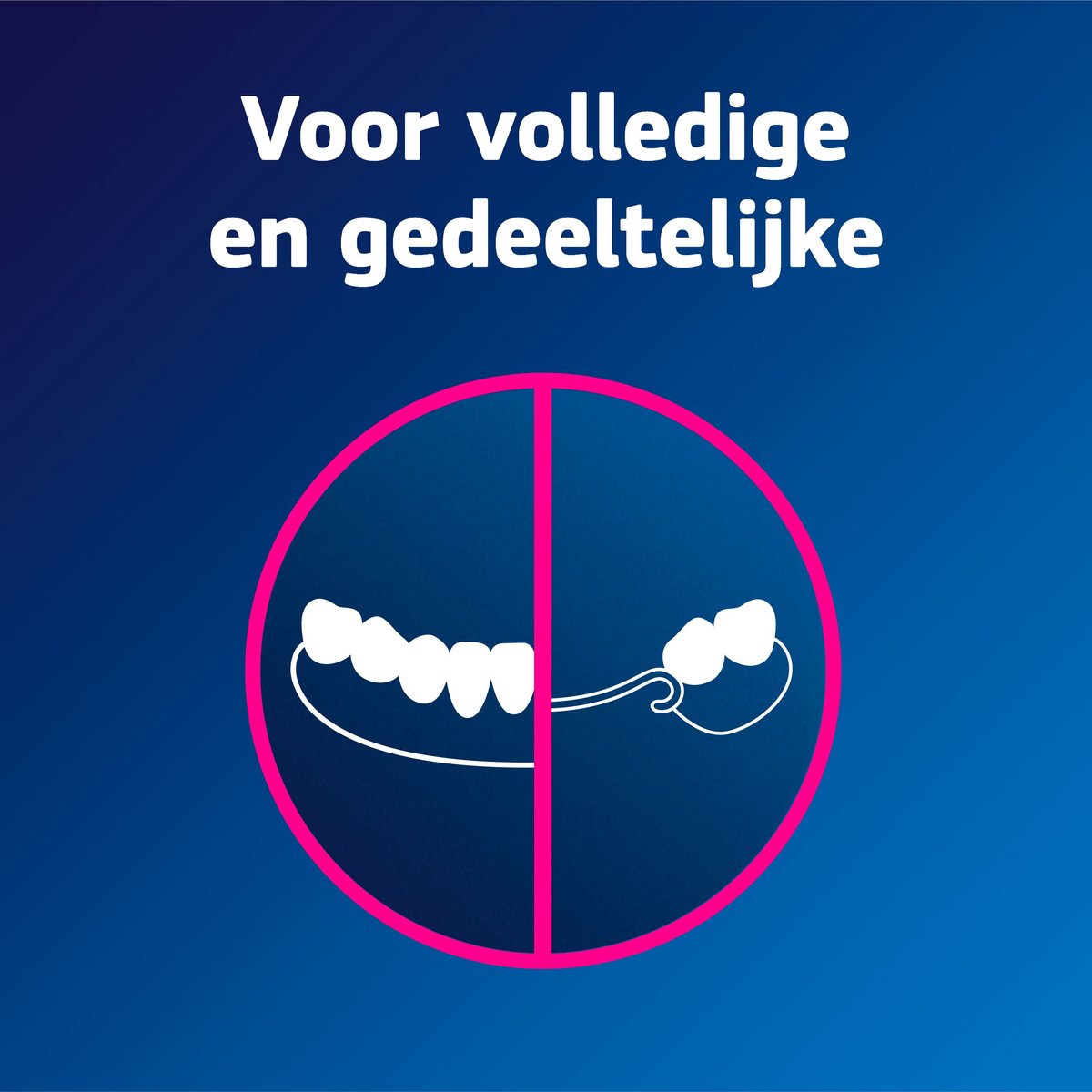 Fixodent Original - Kleefpasta XL